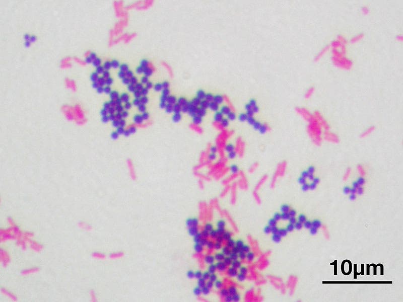 Staphylococcus aureus (dark purple) and Escherichia coli (pink) after Gram staining and counter-staining (Wikimedia commons)