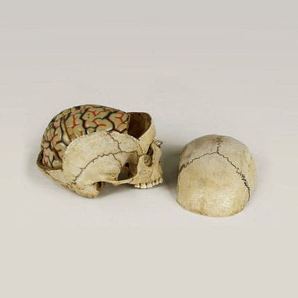 Human skull with wax model of brain inside, from the collection of Frederik Ruysch, now in the Kunstkamera, Saint Petersburg (collection.kunstkamera.ru/)