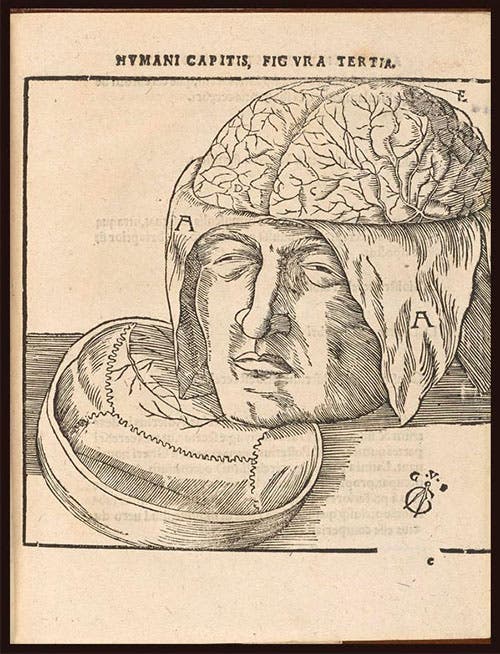 A skull with cranial cap removed to show the brain, woodcut in Johann Dryander, Anatomiae, hoc est, corporis humani dissectionis pars prior, 1537, University of Michigan Libraries (exhibitions.kelsey.lsa.umich.edu)