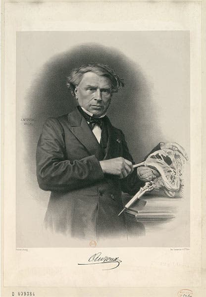 Portrait of Louis Auzoux, engraving, undated (gallica.bnf.fr)
