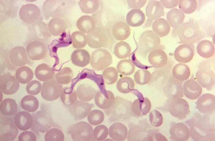 Four Trypanosoma cruzi parasites infecting red blood cells, photomicrograph, 1200X, Center for Disease Control, Public Health Image Library (phil.cdc.gov)
