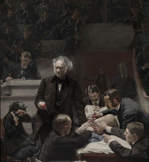 <i>The Gross Clinic</i> (<i>Portrait of Dr. Samuel D. Gross</i>), by Thomas Eakins, 1875 (Philadelphia Museum of Art)