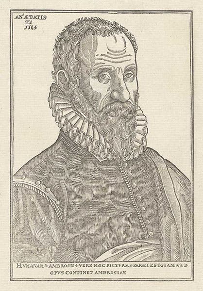 Portrait of Ambroise Paré, age 75, woodcut, unsigned, 1585, Natonal Library of Medicine, Washington, D.C. (nlm.nih.gov)