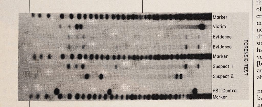 Forensic DNA testing can help confirm a suspect’s guilt or, just as important, exclude a suspect from prosecution. In this image from a sexual assault case, Suspect 1’s DNA pattern is a match with DNA evidence found at the crime scene. Suspect 2 is not a match. Image source: Knight, Pamela. “Biosleuthing with DNA Identification.” Bio/Technology, vol. 8, no. 6, 1990