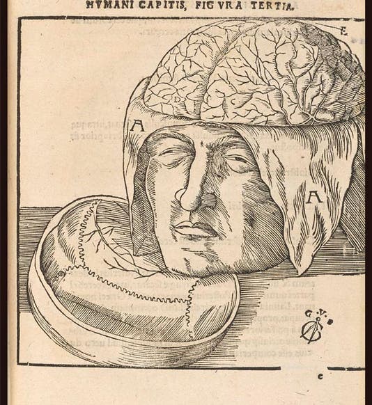 A skull with cranial cap removed to show the brain, woodcut in Johann Dryander, Anatomiae, hoc est, corporis humani dissectionis pars prior, 1537, University of Michigan Libraries (exhibitions.kelsey.lsa.umich.edu)