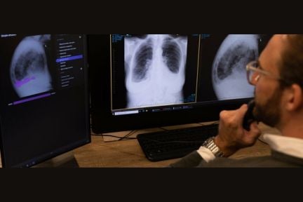 AI in radiology