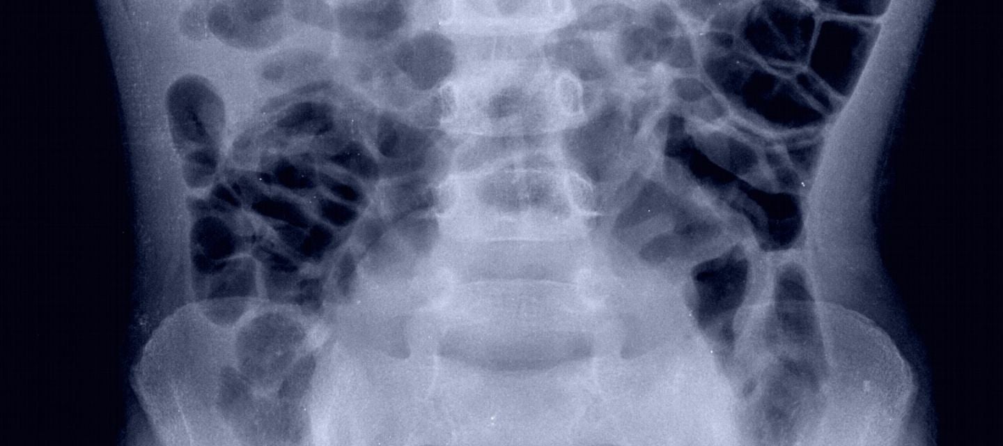 x-ray image of the abdomen