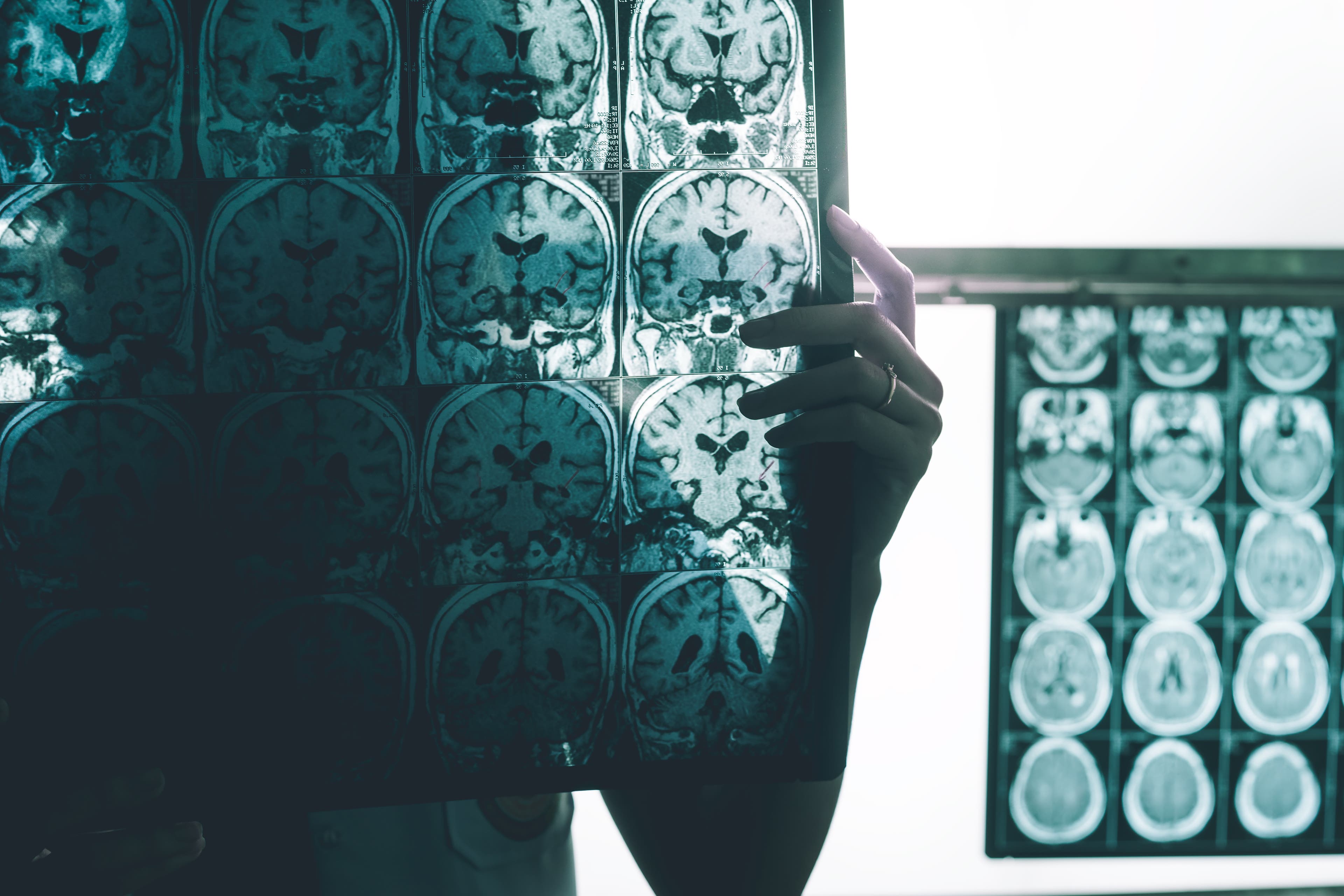 Superior Imaging Capabilities