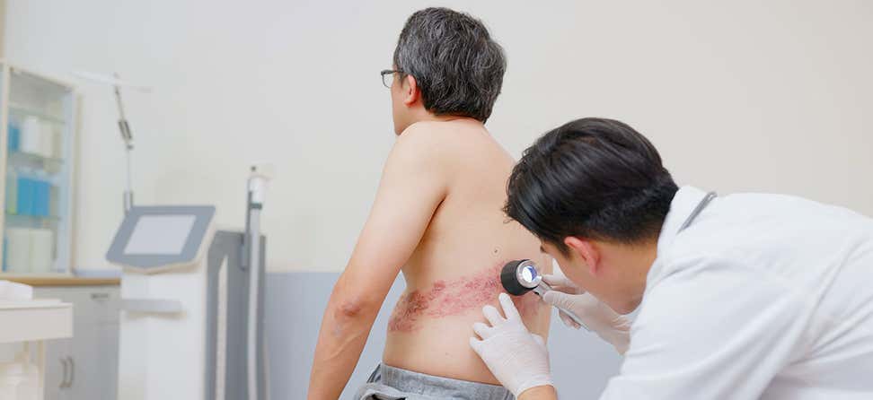 What is shingles? What are the symptoms for shingles? Can shingles return? Learn all about this painful condition and what to do if you get it.