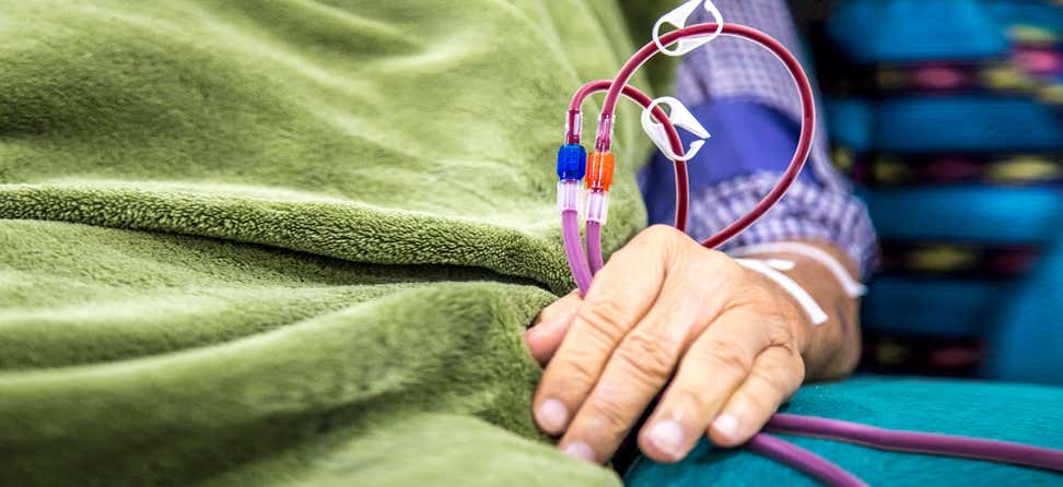 Older Medicare recipient's hand holding tubing while receiving kidney dialysis for end stage renal disease