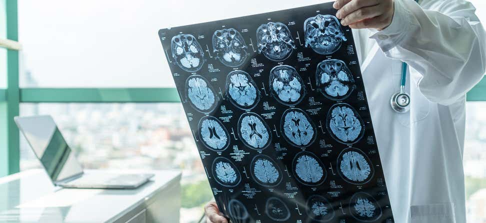 A medical doctor holds Magnetic Resonance Imaging (MRI) film diagnosing a brain disease.